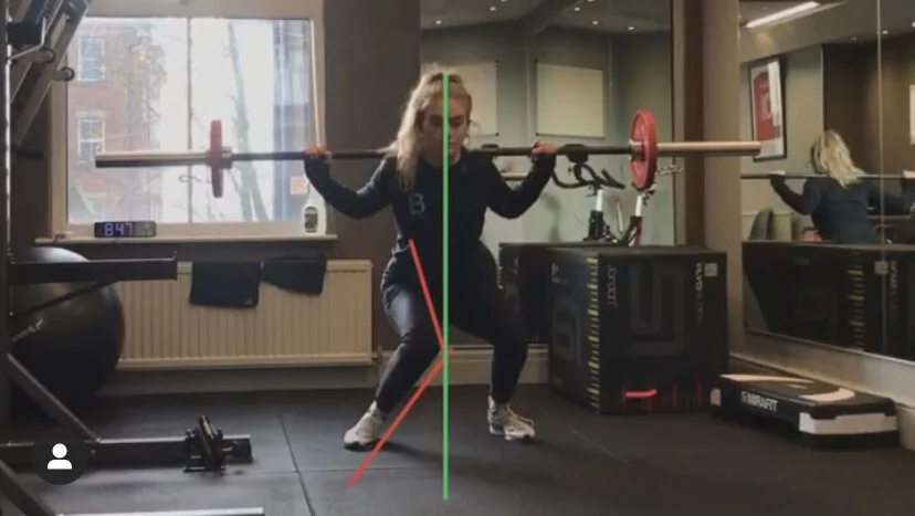 Knee Valgus (image 4)